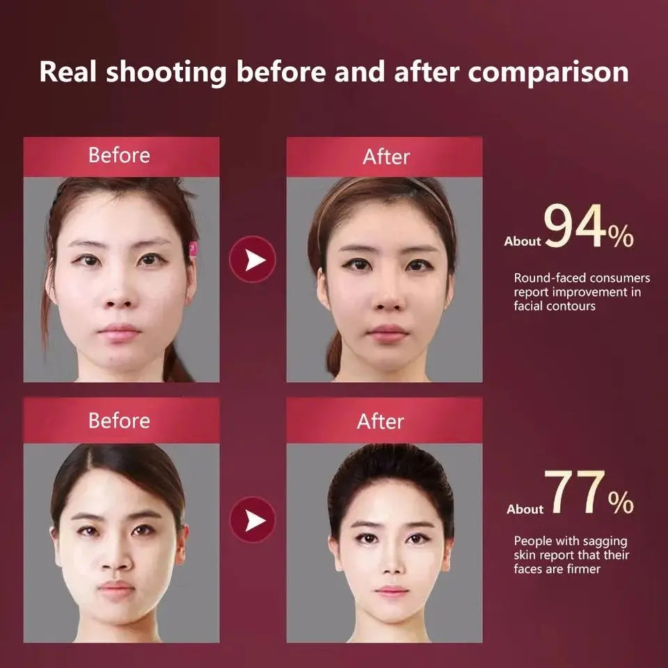FormFit™ Facial Slimming Vibration Massager