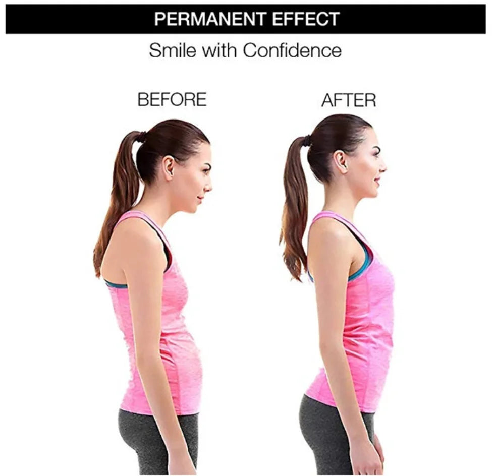 FormFit™ Adjustable Back & Shoulder Posture Corrector