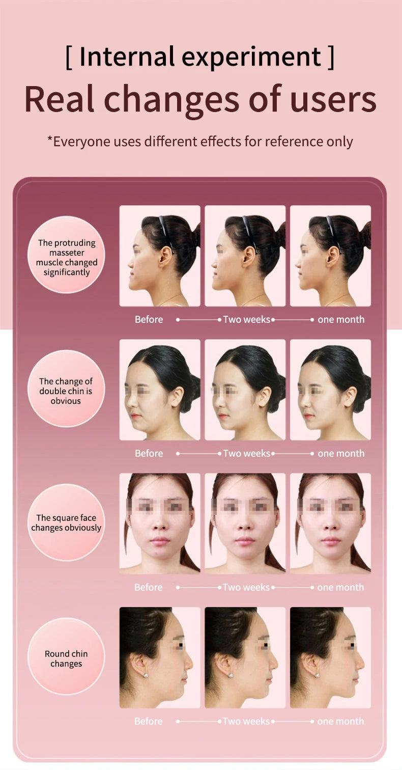 FormFit™ Facial Slimming Vibration Massager